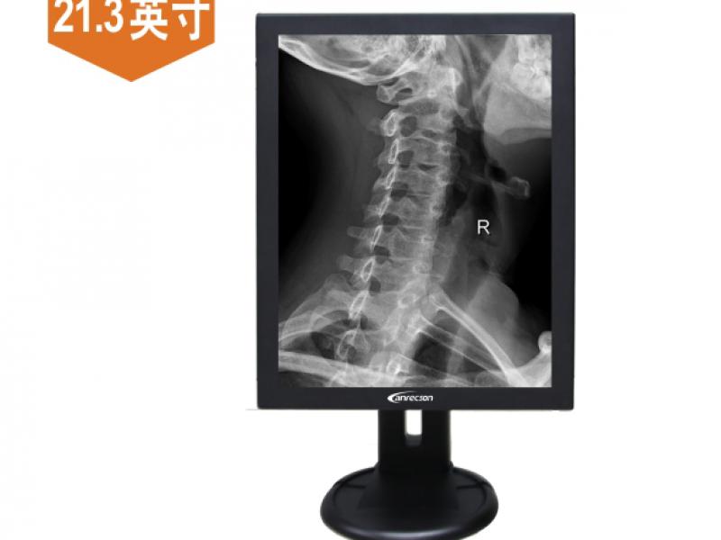 点击大放