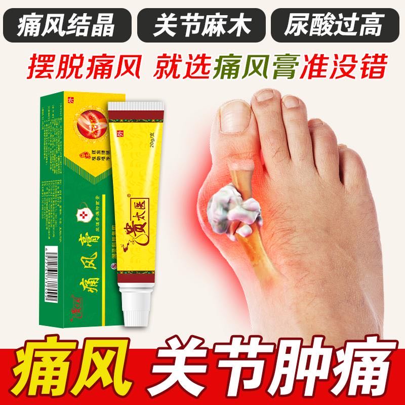 痛风膏乳膏 